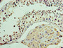 Immunohistochemistry of paraffin-embedded human testis tissue using CAC09447 at dilution of 1:100 Immunohistochemistry of paraffin-embedded human testis tissue using CAC09447 at dilution of 1:100