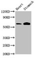 Western Blot; , Positive WB detected in: Rat heart tissue, Mouse stomach tissue; , All lanes: TPH2 antibody at 3µg/ml; , Secondary; , Goat polyclonal to rabbit IgG at 1/50000 dilution; , Predicted band size: 57 kDa; , Observed band size: 57 kDa