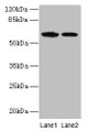 Western blot; All lanes: EGFL6 antibody at 6µg/ml; Lane 1: K562 whole cell lysate; Lane 2: Jurkat whole cell lysate; Secondary; Goat polyclonal to rabbit IgG at 1/10000 dilution; Predicted band size: 62 kDa; Observed band size: 62 kDa Western blot; All lanes: EGFL6 antibody at 6µg/ml; Lane 1: K562 whole cell lysate; Lane 2: Jurkat whole cell lysate; Secondary; Goat polyclonal to rabbit IgG at 1/10000 dilution; Predicted band size: 62 kDa; Observed band size: 62 kDa
