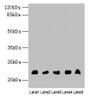 Western blot; All lanes: NRSN1 antibody at 3µg/ml; Lane 1: Mouse stomach tissue; Lane 2: Mouse kidney tissue; Lane 3: Mouse thymus tissue; Lane 4: Hela whole cell lysate; Lane 5: 293T whole cell lysate; Secondary; Goat polyclonal to rabbit IgG at 1/10000 dilution; Predicted band size: 22 kDa; Observed band size: 22 kDa Western blot; All lanes: NRSN1 antibody at 3µg/ml; Lane 1: Mouse stomach tissue; Lane 2: Mouse kidney tissue; Lane 3: Mouse thymus tissue; Lane 4: Hela whole cell lysate; Lane 5: 293T whole cell lysate; Secondary; Goat polyclonal to rabbit IgG at 1/10000 dilution; Predicted band size: 22 kDa; Observed band size: 22 kDa