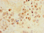 Immunohistochemistry of paraffin-embedded human placenta tissue using CAC09475 at dilution of 1:100 Immunohistochemistry of paraffin-embedded human placenta tissue using CAC09475 at dilution of 1:100