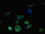 Immunofluorescent analysis of HepG2 cells using CAC09475 at dilution of 1:100 and Alexa Fluor 488-congugated AffiniPure Goat Anti-Rabbit IgG(H+L) Immunofluorescent analysis of HepG2 cells using CAC09475 at dilution of 1:100 and Alexa Fluor 488-congugated AffiniPure Goat Anti-Rabbit IgG(H+L)