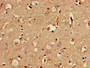 Immunohistochemistry of paraffin-embedded human brain tissue using CAC09497 at dilution of 1:100