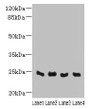 Western blot; All lanes: C4orf33 antibody at 4µg/ml; Lane 1: Mouse kidney tissue; Lane 2: Mouse liver tissue; Lane 3: Mouse lung tissue; Lane 4: Mouse heart tissue; Secondary; Goat polyclonal to rabbit IgG at 1/10000 dilution; Predicted band size: 24 kDa; Observed band size: 24 kDa