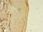 Immunohistochemistry of paraffin-embedded human skin tissue using CAC09503 at dilution of 1:100 Immunohistochemistry of paraffin-embedded human skin tissue using CAC09503 at dilution of 1:100