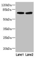 Western blot; All lanes: GALNT15 antibody at 5µg/ml; Lane 1: Mouse liver tissue; Lane 2: Mouse kidney tissue; Secondary; Goat polyclonal to rabbit IgG at 1/10000 dilution; Predicted band size: 74 kDa; Observed band size: 74 kDa Western blot; All lanes: GALNT15 antibody at 5µg/ml; Lane 1: Mouse liver tissue; Lane 2: Mouse kidney tissue; Secondary; Goat polyclonal to rabbit IgG at 1/10000 dilution; Predicted band size: 74 kDa; Observed band size: 74 kDa