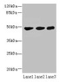 Western blot; All lanes: UXS1 antibody at 6µg/ml; Lane 1: Mouse lung tissue; Lane 2: Jurkat whole cell lysate; Lane 3: HepG2 whole cell lysate; Secondary; Goat polyclonal to rabbit IgG at 1/10000 dilution; Predicted band size: 48, 49, 29 kDa; Observed band size: 48 kDa Western blot; All lanes: UXS1 antibody at 6µg/ml; Lane 1: Mouse lung tissue; Lane 2: Jurkat whole cell lysate; Lane 3: HepG2 whole cell lysate; Secondary; Goat polyclonal to rabbit IgG at 1/10000 dilution; Predicted band size: 48, 49, 29 kDa; Observed band size: 48 kDa