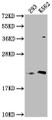 Western Blot; , Positive WB detected in: 293 whole cell lysate, K562 whole cell lysate; , All lanes: HDDC3 antibody at 1:2000; , Secondary; , Goat polyclonal to rabbit IgG at 1/50000 dilution; , Predicted band size: 21, 16 kDa; , Observed band size: 21 kDa; Western Blot; , Positive WB detected in: 293 whole cell lysate, K562 whole cell lysate; , All lanes: HDDC3 antibody at 1:2000; , Secondary; , Goat polyclonal to rabbit IgG at 1/50000 dilution; , Predicted band size: 21, 16 kDa; , Observed band size: 21 kDa;