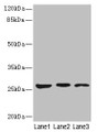 Western blot; All lanes: KLK6 antibody at 5µg/ml; Lane 1: Mouse liver tissue; Lane 2: Mouse brain tissue; Lane 3: A375 whole cell lysate; Secondary; Goat polyclonal to rabbit IgG at 1/10000 dilution; Predicted band size: 27, 16, 5 kDa; Observed band size: 27 kDa