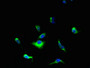Immunofluorescent analysis of HepG2 cells using CAC09562 at dilution of 1:100 and Alexa Fluor 488-congugated AffiniPure Goat Anti-Rabbit IgG(H+L) Immunofluorescent analysis of HepG2 cells using CAC09562 at dilution of 1:100 and Alexa Fluor 488-congugated AffiniPure Goat Anti-Rabbit IgG(H+L)