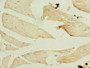 Immunohistochemistry of paraffin-embedded human skeletal muscle tissue using CAC09587 at dilution of 1:100