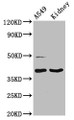 Western Blot; Positive WB detected in: A549 whole cell lysate, Rat kidney tissue; All lanes: LGALS12 antibody at 3µg/ml; Secondary; Goat polyclonal to rabbit IgG at 1/50000 dilution; Predicted band size: 38, 32, 37, 30, 36 kDa; Observed band size: 38 kDa Western Blot; Positive WB detected in: A549 whole cell lysate, Rat kidney tissue; All lanes: LGALS12 antibody at 3µg/ml; Secondary; Goat polyclonal to rabbit IgG at 1/50000 dilution; Predicted band size: 38, 32, 37, 30, 36 kDa; Observed band size: 38 kDa