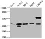 Western blot; All lanes: CLYBL antibody at 1µg/ml; Lane 1: Hela whole cell lysate; Lane 2: NIH/3T3 whole cell lysate; Secondary; Goat polyclonal to rabbit IgG at 1/10000 dilution; Predicted band size: 38, 34 kDa; Observed band size: 38 kDa