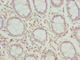 Immunohistochemistry of paraffin-embedded human colon tissue using CAC09636 at dilution of 1:100