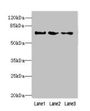 Western blot; All lanes: PPIL4 antibody at 4µg/ml; Lane 1: Hela whole cell lysate; Lane 2: Mouse kidney tissue; Lane 3: HepG2 whole cell lysate; Secondary; Goat polyclonal to rabbit IgG at 1/10000 dilution; Predicted band size: 58 kDa; Observed band size: 70 kDa