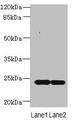 Western blot; All lanes: MRAP2 antibody at 7µg/ml; Lane 1: Mouse brain tissue; Lane 2: Mouse kidney tissue; Secondary; Goat polyclonal to rabbit IgG at 1/10000 dilution; Predicted band size: 24 kDa; Observed band size: 24 kDa