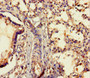 Immunohistochemistry of paraffin-embedded human lung tissue using CAC09655 at dilution of 1:100