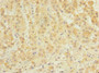 Immunohistochemistry of paraffin-embedded human adrenal gland tissue using CAC09664 at dilution of 1:100 Immunohistochemistry of paraffin-embedded human adrenal gland tissue using CAC09664 at dilution of 1:100