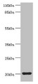 Western blot; All lanes: MYLPF antibody at 2µg/ml + Mouse skeletal muscle tissue; Secondary; Goat polyclonal to rabbit IgG at 1/10000 dilution; Predicted band size: 20 kDa; Observed band size: 20 kDa