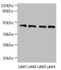 Western blot; All lanes: NOL4L antibody at 0.3µg/ml; Lane 1: PC-3 whole cell lysate; Lane 2: A549 whole cell lysate; Lane 3: HepG2 whole cell lysate; Lane 4: K562 whole cell lysate; Secondary; Goat polyclonal to rabbit IgG at 1/10000 dilution; Predicted band size: 48, 44 kDa; Observed band size: 48 kDa Western blot; All lanes: NOL4L antibody at 0.3µg/ml; Lane 1: PC-3 whole cell lysate; Lane 2: A549 whole cell lysate; Lane 3: HepG2 whole cell lysate; Lane 4: K562 whole cell lysate; Secondary; Goat polyclonal to rabbit IgG at 1/10000 dilution; Predicted band size: 48, 44 kDa; Observed band size: 48 kDa
