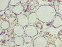 Immunohistochemistry of paraffin-embedded human thyroid tissue using CAC09686 at dilution of 1:100 Immunohistochemistry of paraffin-embedded human thyroid tissue using CAC09686 at dilution of 1:100