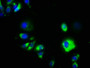 Immunofluorescence staining of MCF-7 cells with CAC09689 at 1:133, counter-stained with DAPI. The cells were fixed in 4% formaldehyde, permeabilized using 0.2% Triton X-100 and blocked in 10% normal Goat Serum. The cells were then incubated with the antibody overnight at 4°C. The secondary antibody was Alexa Fluor 488-congugated AffiniPure Goat Anti-Rabbit IgG(H+L).