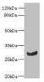 Western blot; All lanes: C11orf68 antibody at 3µg/ml + Mouse liver tissue; Secondary; Goat polyclonal to rabbit IgG at 1/10000 dilution; Predicted band size: 28, 32 kDa; Observed band size: 28 kDa