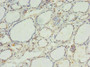 Immunohistochemistry of paraffin-embedded human thyroid tissue using CAC09713 at dilution of 1:100
