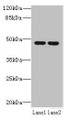 Western blot; All lanes: ZDHHC6 antibody at 0.2µg/ml; Lane 1: NIH/3T3 whole cell lysate; Lane 2: K562 whole cell lysate; Secondary; Goat polyclonal to rabbit IgG at 1/10000 dilution; Predicted band size: 48 kDa; Observed band size: 48 kDa