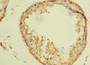 Immunohistochemistry of paraffin-embedded human testis tissue using CAC09725 at dilution of 1:100