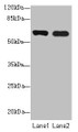 Western blot; All lanes: SPTLC3 antibody at 0.2µg/ml; Lane 1: Mouse kidney tissue; Lane 2: U87 whole cell lysate; Secondary; Goat polyclonal to rabbit IgG at 1/10000 dilution; Predicted band size: 63, 20 kDa; Observed band size: 63 kDa