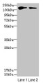 Western blot; All lanes: FYCO1 antibody at 2.5µg/ml; Lane 1: HepG2 whole cell lysate; Lane 2: Mouse liver tissue; Secondary; Goat polyclonal to rabbit IgG at 1/10000 dilution; Predicted band size: 167, 44, 169 kDa; Observed band size: 167 kDa