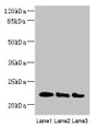 Western blot; All lanes: ARL8B antibody at 4µg/ml; Lane 1: Mouse brain tissue; Lane 2: NIH/3T3 whole cell lysate; Lane 3: Jurkat whole cell lysate; Secondary; Goat polyclonal to rabbit IgG at 1/10000 dilution; Predicted band size: 22, 19 kDa; Observed band size: 22 kDa Western blot; All lanes: ARL8B antibody at 4µg/ml; Lane 1: Mouse brain tissue; Lane 2: NIH/3T3 whole cell lysate; Lane 3: Jurkat whole cell lysate; Secondary; Goat polyclonal to rabbit IgG at 1/10000 dilution; Predicted band size: 22, 19 kDa; Observed band size: 22 kDa
