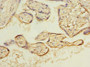 Immunohistochemistry of paraffin-embedded human placenta tissue using CAC09770 at dilution of 1:100 Immunohistochemistry of paraffin-embedded human placenta tissue using CAC09770 at dilution of 1:100