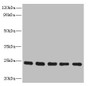 Western blot; All lanes: RAB6B antibody at 5µg/ml; Lane 1: Mouse brain tissue; Lane 2: U251 whole cell lysate; Lane 3: MCF-7 whole cell lysate; Lane 4: A549 whole cell lysate; Lane 5: K562 whole cell lysate; Secondary; Goat polyclonal to rabbit IgG at 1/10000 dilution; Predicted band size: 24, 23 kDa; Observed band size: 24 kDa;