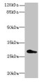 Western blot; All lanes: REEP4 antibody at 0.7µg/ml + U251 whole cell lysate; Secondary; Goat polyclonal to rabbit IgG at 1/10000 dilution; Predicted band size: 30, 20 kDa; Observed band size: 30 kDa;