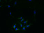 Immunofluorescent analysis of Hela cells using CAC09812 at dilution of 1:100 and Alexa Fluor 488-congugated AffiniPure Goat Anti-Rabbit IgG(H+L)