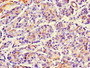 Immunohistochemistry of paraffin-embedded human pancreatic tissue using CAC09834 at dilution of 1:100 Immunohistochemistry of paraffin-embedded human pancreatic tissue using CAC09834 at dilution of 1:100