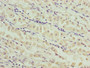 Immunohistochemistry of paraffin-embedded human gastric cancer using CAC09839 at dilution of 1:100