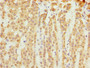Immunohistochemistry of paraffin-embedded human adrenal gland tissue using CAC09844 at dilution of 1:100