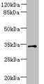 Western blot; All lanes: ZDHHC3 antibody at 1.5µg/ml + Mouse brain tissue; Secondary; Goat polyclonal to rabbit IgG at 1/10000 dilution; Predicted band size: 35, 38 kDa; Observed band size: 35 kDa;