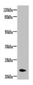 Western blot; All lanes: NRSN2 antibody at 3µg/ml + Mouse liver tissue; Secondary; Goat polyclonal to rabbit IgG at 1/10000 dilution; Predicted band size: 22 kDa; Observed band size: 22 kDa;
