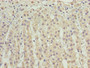 Immunohistochemistry of paraffin-embedded human adrenal gland tissue using CAC09879 at dilution of 1:100