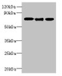 Western blot; All lanes: SLC23A1 antibody at 3µg/ml; Lane 1: A549 whole cell lysate; Lane 2: Mouse liver tissue; Lane 3: Mouse kidney tissue; Secondary; Goat polyclonal to rabbit IgG at 1/10000 dilution; Predicted band size: 65, 66, 29 kDa; Observed band size: 65 kDa; Western blot; All lanes: SLC23A1 antibody at 3µg/ml; Lane 1: A549 whole cell lysate; Lane 2: Mouse liver tissue; Lane 3: Mouse kidney tissue; Secondary; Goat polyclonal to rabbit IgG at 1/10000 dilution; Predicted band size: 65, 66, 29 kDa; Observed band size: 65 kDa;