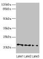Western blot; All lanes: VPS25 antibody at 3µg/ml; Lane 1: Mouse kidney tissue; Lane 2: HL60 whole cell lysate; Lane 3: THP-1 whole cell lysate; Secondary; Goat polyclonal to rabbit IgG at 1/10000 dilution; Predicted band size: 21 kDa; Observed band size: 21 kDa Western blot; All lanes: VPS25 antibody at 3µg/ml; Lane 1: Mouse kidney tissue; Lane 2: HL60 whole cell lysate; Lane 3: THP-1 whole cell lysate; Secondary; Goat polyclonal to rabbit IgG at 1/10000 dilution; Predicted band size: 21 kDa; Observed band size: 21 kDa