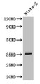 Western Blot; Positive WB detected in: Ntera-2 whole cell lysate; All lanes: NANOG antibody at 3µg/ml; Secondary; Goat polyclonal to rabbit IgG at 1/50000 dilution; Predicted band size: 35, 33 kDa; Observed band size: 35 kDa Western Blot; Positive WB detected in: Ntera-2 whole cell lysate; All lanes: NANOG antibody at 3µg/ml; Secondary; Goat polyclonal to rabbit IgG at 1/50000 dilution; Predicted band size: 35, 33 kDa; Observed band size: 35 kDa