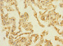 Immunohistochemistry of paraffin-embedded human lung tissue using CAC09921 at dilution of 1:100