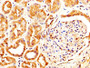 IHC image diluted at 1:600 and staining in paraffin-embedded human kidney tissue performed on a Leica BondTM system. After dewaxing and hydration, antigen retrieval was mediated by high pressure in a citrate buffer (pH 6.0). Section was blocked with 10% normal goat serum 30min at RT. Then primary antibody (1% BSA) was incubated at 4°C overnight. The primary is detected by a biotinylated secondary antibody and visualized using an HRP conjugated SP system. IHC image diluted at 1:600 and staining in paraffin-embedded human kidney tissue performed on a Leica BondTM system. After dewaxing and hydration, antigen retrieval was mediated by high pressure in a citrate buffer (pH 6.0). Section was blocked with 10% normal goat serum 30min at RT. Then primary antibody (1% BSA) was incubated at 4°C overnight. The primary is detected by a biotinylated secondary antibody and visualized using an HRP conjugated SP system.