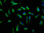 Immunofluorescence staining of U251 cells with CAC09936 at 1:250, counter-stained with DAPI. The cells were fixed in 4% formaldehyde, permeabilized using 0.2% Triton X-100 and blocked in 10% normal Goat Serum. The cells were then incubated with the antibody overnight at 4°C. The secondary antibody was Alexa Fluor 488-congugated AffiniPure Goat Anti-Rabbit IgG(H+L). Immunofluorescence staining of U251 cells with CAC09936 at 1:250, counter-stained with DAPI. The cells were fixed in 4% formaldehyde, permeabilized using 0.2% Triton X-100 and blocked in 10% normal Goat Serum. The cells were then incubated with the antibody overnight at 4°C. The secondary antibody was Alexa Fluor 488-congugated AffiniPure Goat Anti-Rabbit IgG(H+L).