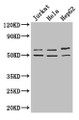 Western Blot; Positive WB detected in: Jurkat whole cell lysate, Hela whole cell lysate, HepG2 whole cell lysate; All lanes: YTHDF2 antibody at 2.7µg/ml; Secondary; Goat polyclonal to rabbit IgG at 1/50000 dilution; Predicted band size: 63, 57 kDa; Observed band size: 63, 50 kDa; Western Blot; Positive WB detected in: Jurkat whole cell lysate, Hela whole cell lysate, HepG2 whole cell lysate; All lanes: YTHDF2 antibody at 2.7µg/ml; Secondary; Goat polyclonal to rabbit IgG at 1/50000 dilution; Predicted band size: 63, 57 kDa; Observed band size: 63, 50 kDa;